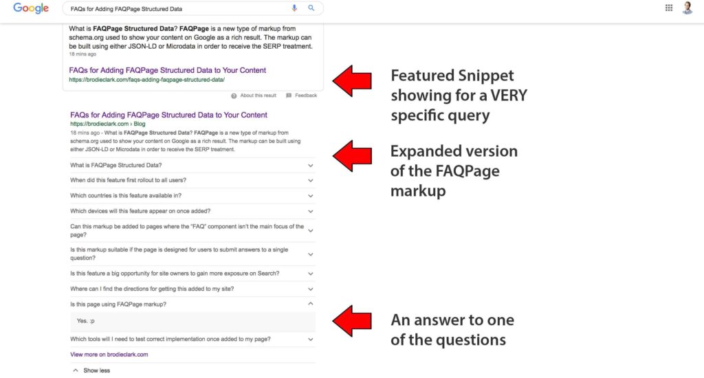 Schema FAQPage (Cấu trúc hóa câu hỏi thường gặp)